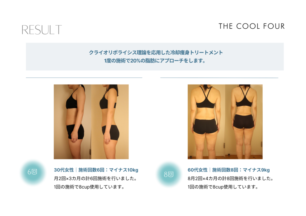 最新　脂肪冷却　美容機器　2本同時稼働 最新脂肪冷却痩身マシン LUMIX lipocool®(ルミクス リポクール